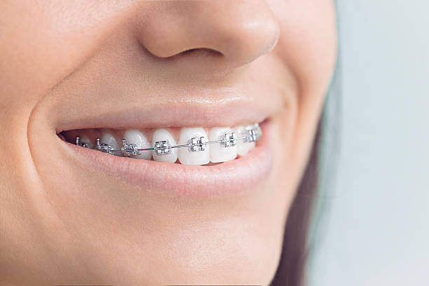 Trusted Falling Waters, WV Dental Services Experts
